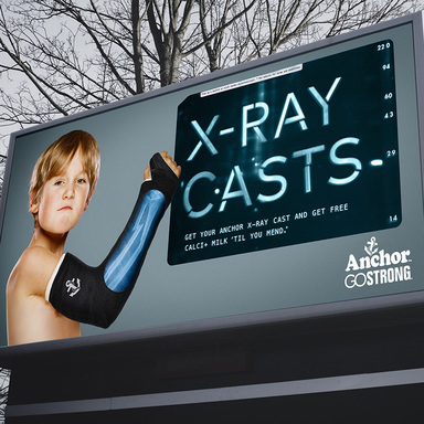 X-Ray Casts